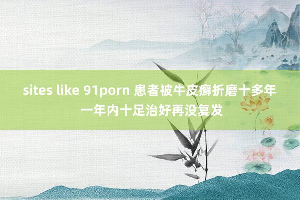 sites like 91porn 患者被牛皮癣折磨十多年 一年内十足治好再没复发