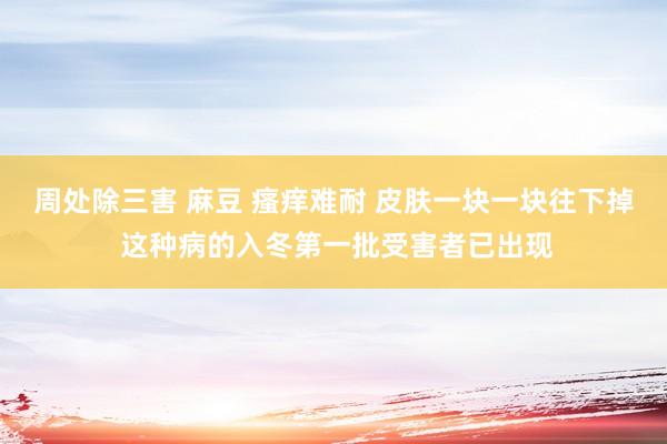 周处除三害 麻豆 瘙痒难耐 皮肤一块一块往下掉 这种病的入冬第一批受害者已出现